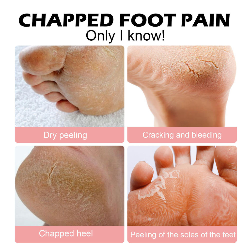 Hand and Foot Moisturizing Stick
