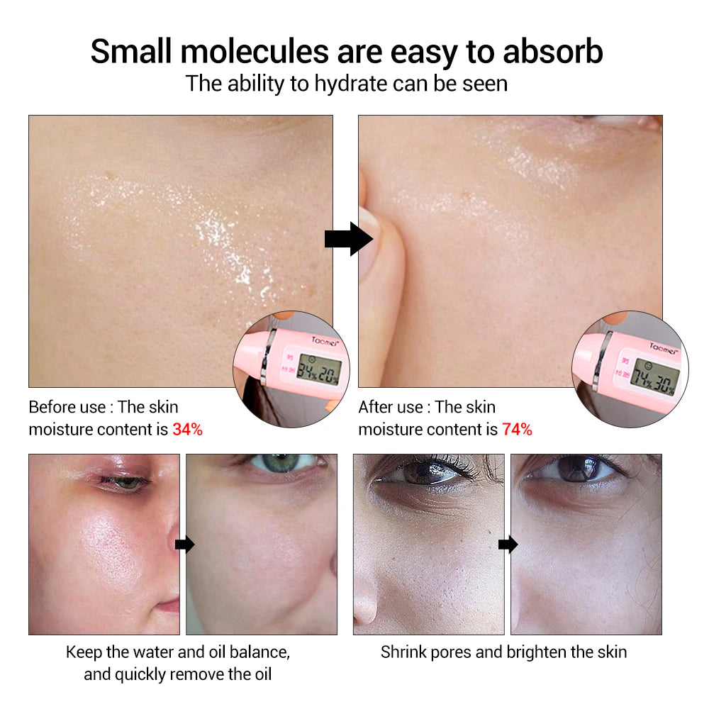 Hyaluronic Acid Serum for Blackhead