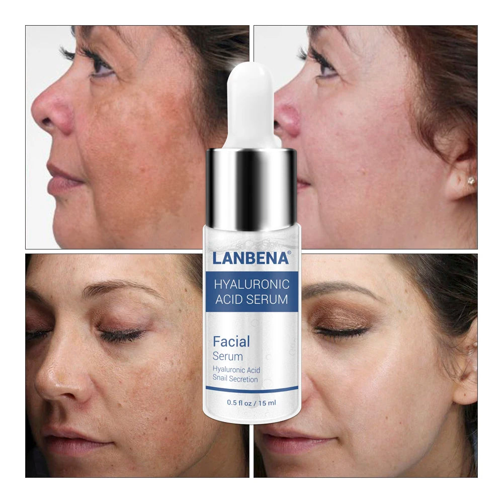 Hyaluronic Acid Serum for Blackhead